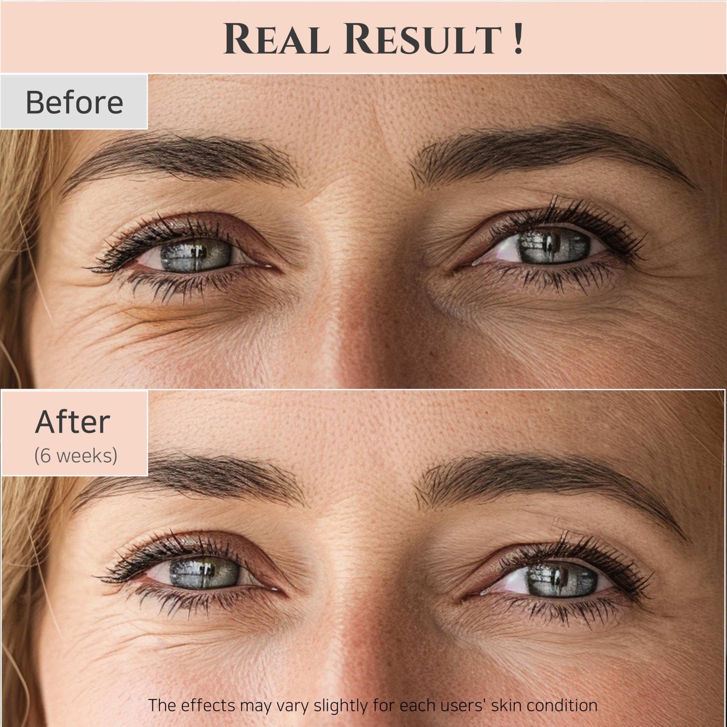 Joseon Radiant Eye Serum: Retinal & Niacinamide 30ml - Handbags Specialist Headquarter