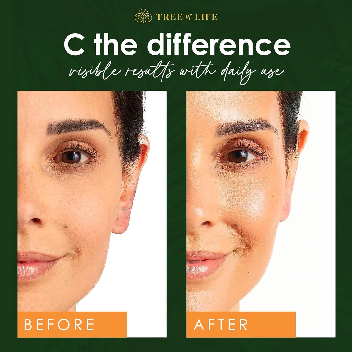 Radiant Glow Vitamin C Skin Care Set - Handbags Specialist Headquarter