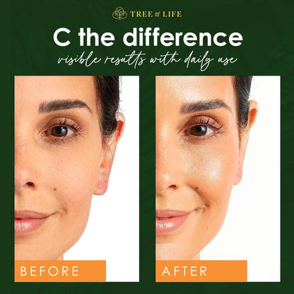 Radiant Glow Vitamin C Skin Care Set - Handbags Specialist Headquarter
