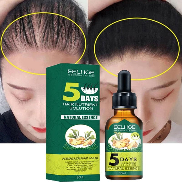 Ginger Hair Growth Products Natural Anti Hair Loss Prevent Baldness Treatment Fast Growing Nourish Dry Damaged Hair Care - Premium Health from S MEIER Store - Just $17.99! Shop now at Handbags Specialist Headquarter