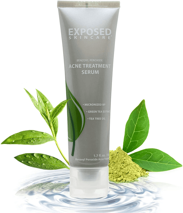Exposed Skin Care Acne Treatment Serum Step 3 – Quickly Reduces Pimple Size and Redness - 12 Hour Spot Treatment - 3.5% Benzoyl Peroxide, Natural Green Tea & Tea Tree Oil - Premium  from Exposed Skin Care - Just $41.12! Shop now at Handbags Specialist Headquarter